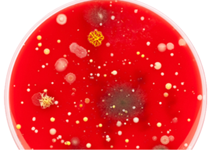 bacteria