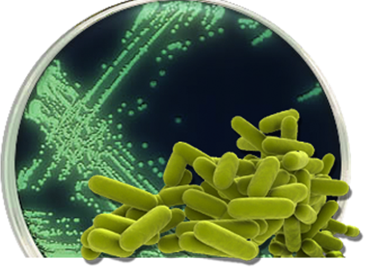 Legionella